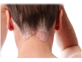 Laser Hair Removal & Treatment in Jaipur | Rejuvenate Clinic